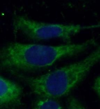 EGFR Specific Rabbit Polyclonal Antibody