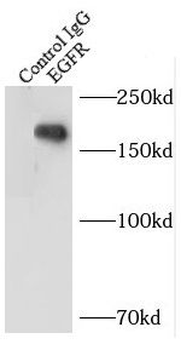 EGFR Specific Rabbit Polyclonal Antibody