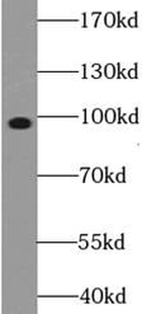 AGO1 Specific Rabbit Polyclonal Antibody