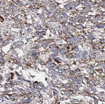 AGO1 Specific Rabbit Polyclonal Antibody