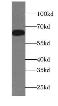 EIF3D Mouse Monoclonal Antibody