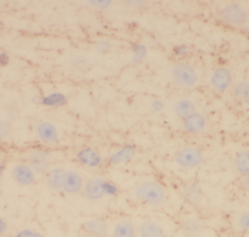 EIF3D Mouse Monoclonal Antibody