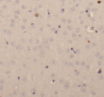 EPB41L3 Antibody
