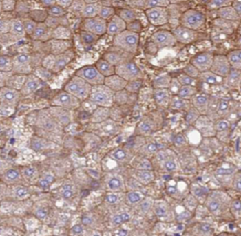 EPHA1 specific Rabbit Polyclonal Antibody