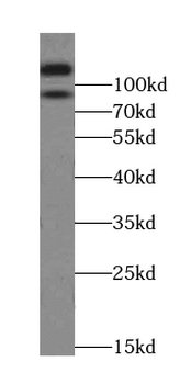 LIMA1 Mouse Monoclonal Antibody