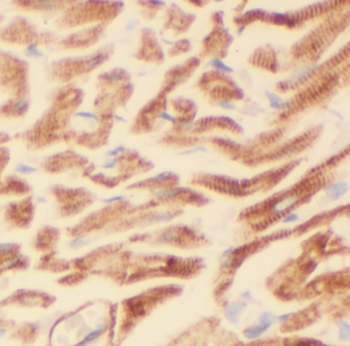 LIMA1 Mouse Monoclonal Antibody