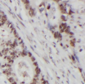 EXOSC2 Mouse Monoclonal Antibody