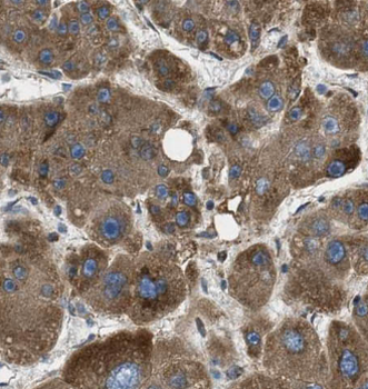 F12 Mouse Monoclonal Antibody