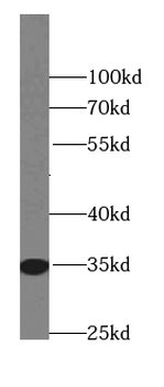 ZC2HC1C Rabbit Polyclonal Antibody