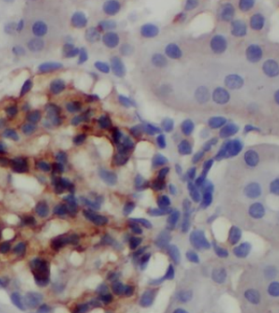 ZC2HC1C Rabbit Polyclonal Antibody