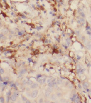 ABRAXAS1 Rabbit Polyclonal Antibody