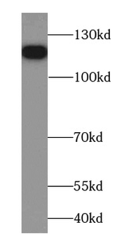 FAM186B Antibody