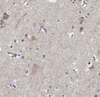 TAFA5 Antibody