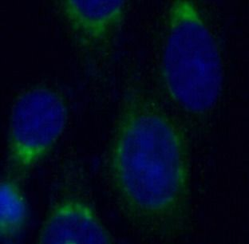 FAM3C Antibody