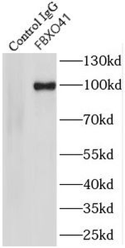 FBXO41 Rabbit Polyclonal Antibody