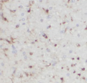 FBXO41 Rabbit Polyclonal Antibody