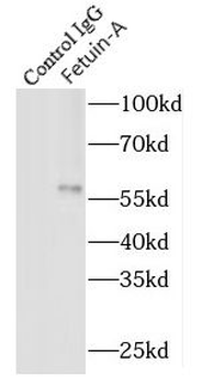 AHSG Antibody