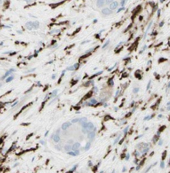 FKBP2 Mouse Monoclonal Antibody