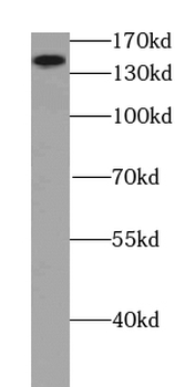 ATAD5 Antibody