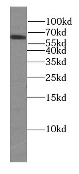 FUT8 Antibody