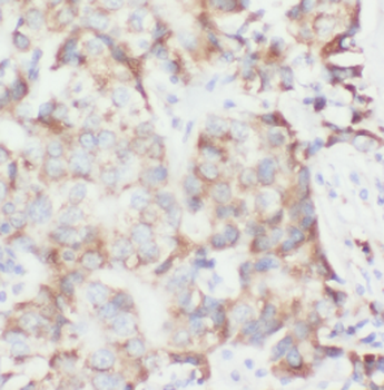 FUT8 Mouse Monoclonal Antibody