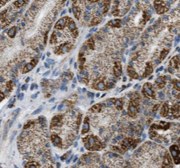 FUT9 Mouse Monoclonal Antibody