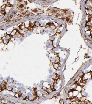 FXYD4 Antibody