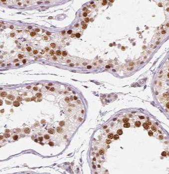GATA4 Rabbit Polyclonal Antibody