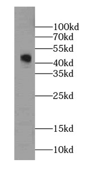 GDI2 Antibody
