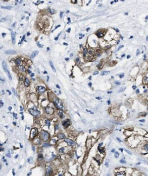ARHGEF25 Specific Rabbit Polyclonal Antibody