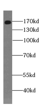 GEMIN5 Rabbit Polyclonal Antibody