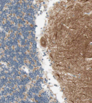 GEMIN5 Rabbit Polyclonal Antibody