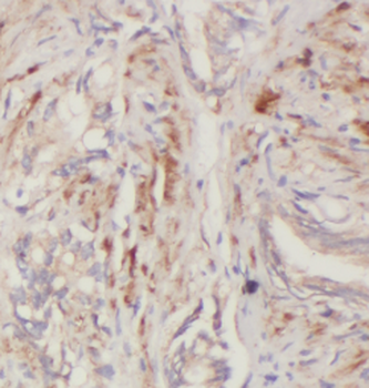 QARS1 Rabbit Polyclonal Antibody