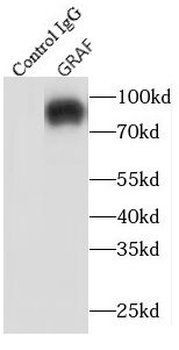 ARHGAP26 Rabbit Polyclonal Antibody