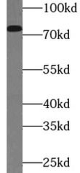 HSPA5 Rabbit Polyclonal Antibody