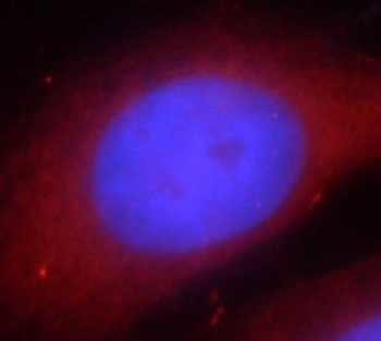 HSPA5 Rabbit Polyclonal Antibody