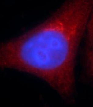 ADH5 Mouse Monoclonal Antibody