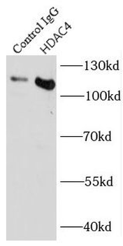 HDAC4 specific Rabbit Polyclonal Antibody
