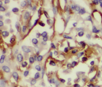 HDAC4 specific Rabbit Polyclonal Antibody