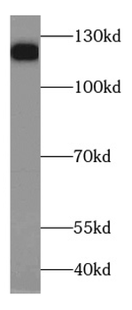 HDAC5 Rabbit Polyclonal Antibody