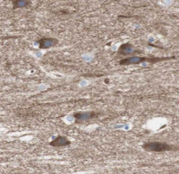 HDAC5 Rabbit Polyclonal Antibody
