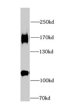 HDAC6 Rabbit Polyclonal Antibody