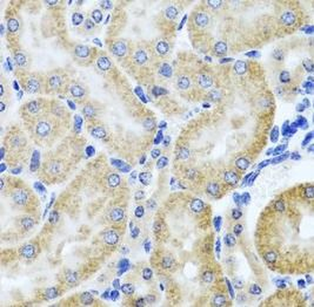 HDAC6 Rabbit Polyclonal Antibody