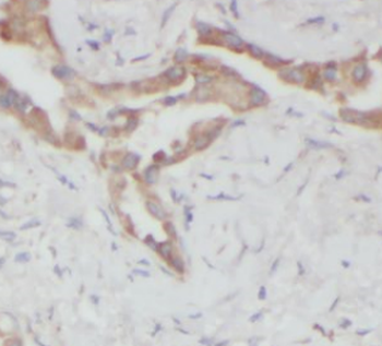 HIKESHI Rabbit Polyclonal Antibody