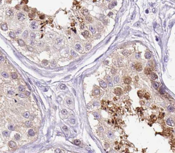 ZDHHC17 Rabbit Polyclonal Antibody