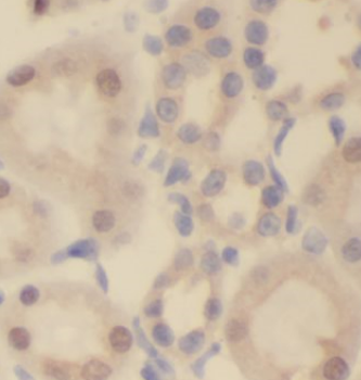 IST1 Rabbit Polyclonal Antibody
