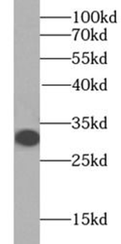 Histone H1.2 Rabbit Polyclonal Antibody