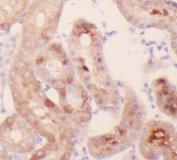 HRAS Specific Rabbit Polyclonal Antibody