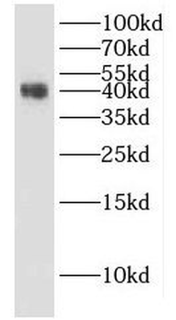 HuA/B/C/D Antibody