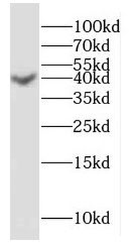 HuD Rabbit Polyclonal Antibody
